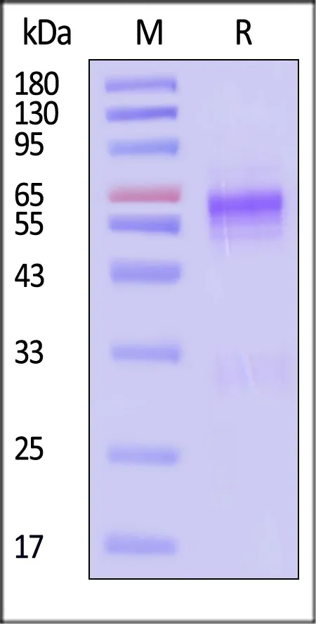 SARS Nucleocapsid protein, His Tag - image 1