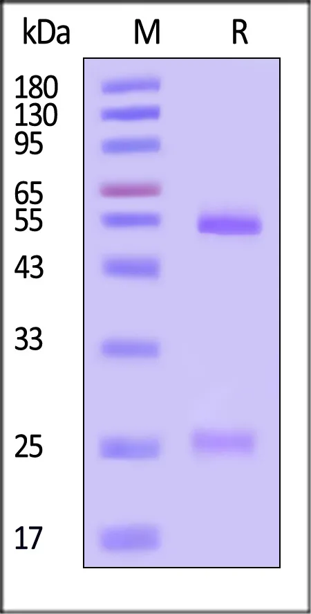 Anti-SARS-CoV-2 Spike RBD Broadly Neutralizing Antibody, Human IgG3 (AM359b) (MALS verified) - image 1