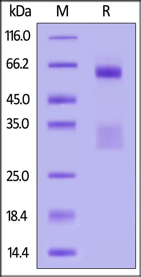 SARS-CoV-2 Nucleocapsid protein, His Tag (BA.2*&BA.3*/Omicron) - image 1