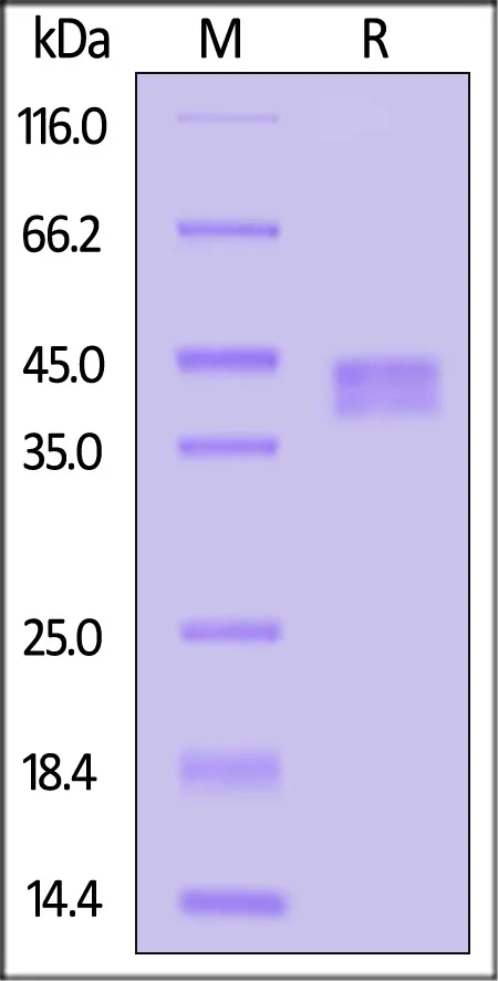 Rat Fc gamma RI / CD64 Protein, His Tag (MALS verified) - image 1