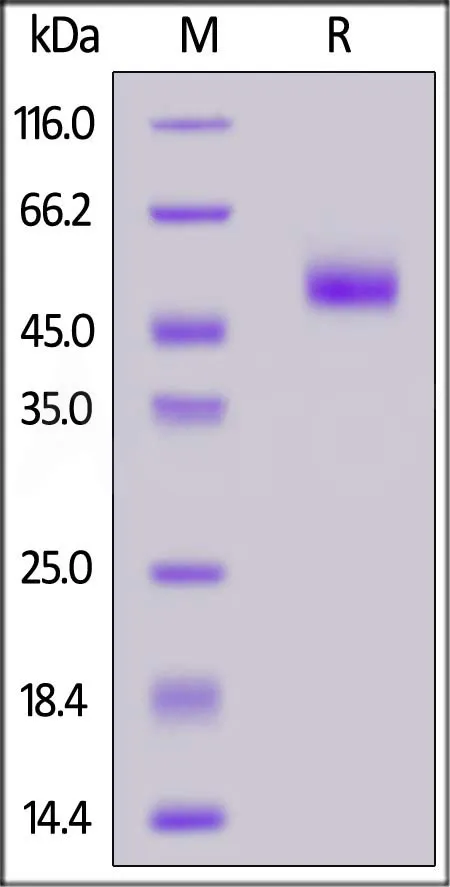 Human 4-1BB / TNFRSF9 (87-186) Protein, Fc Tag (MALS verified) - image 1