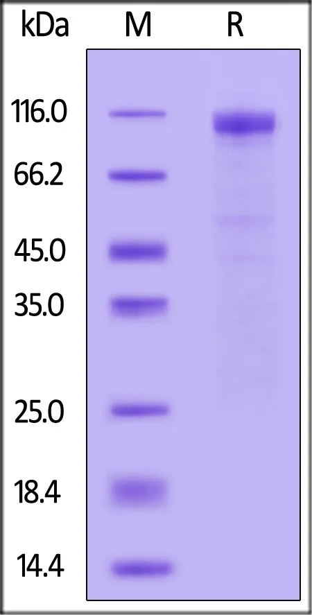 SARS-CoV-2 Spike S1 Protein, His Tag (BA.2/Omicron) - image 1