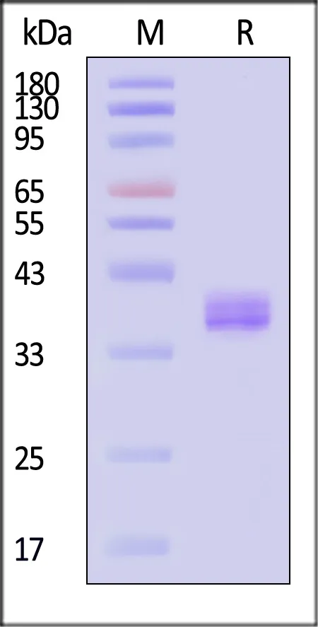 Human Apolipoprotein E / APOE4 Protein, Tag Free (MALS verified) - image 1