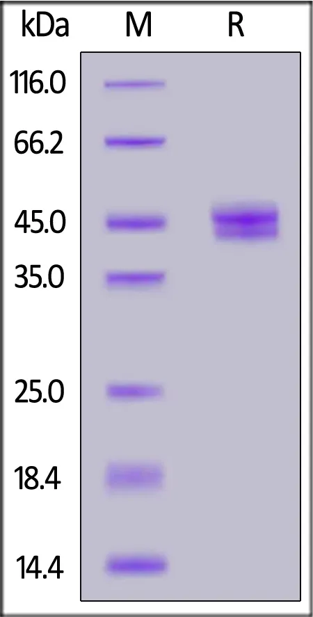 Human CCL2 / MCP-1 Protein, Fc Tag (MALS verified) - image 1