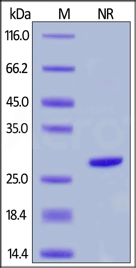 Human Complement Factor D / CFD Protein, His Tag (active enzyme) - image 1