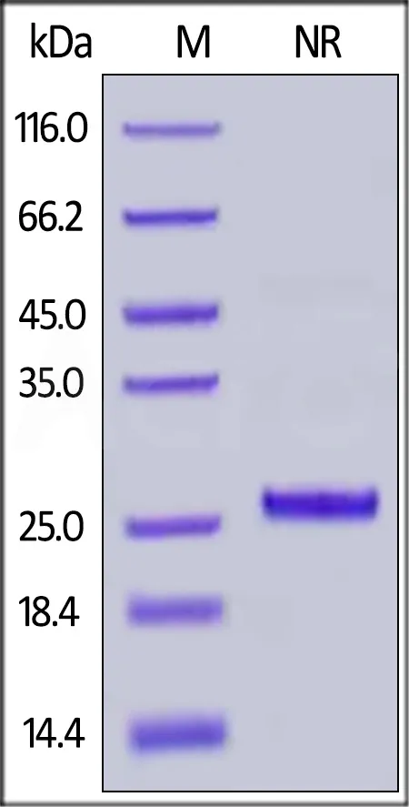 Rhesus macaque / Cynomolgus Complement Factor D / CFD Protein, His Tag (active enzyme) - image 1