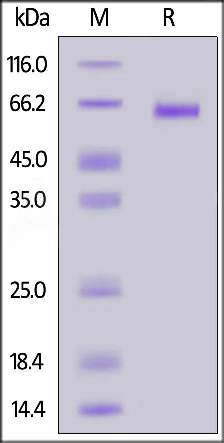 Nipah virus Pre-Fusion glycoprotein, His Tag (MALS verified) - image 1