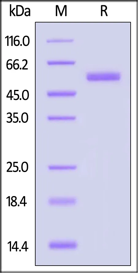Nipah virus Post-Fusion glycoprotein, His Tag (MALS verified) - image 1