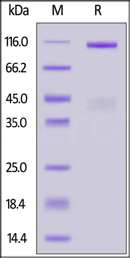 Human HGF R / c-MET Protein, Fc Tag (MALS verified) - image 1