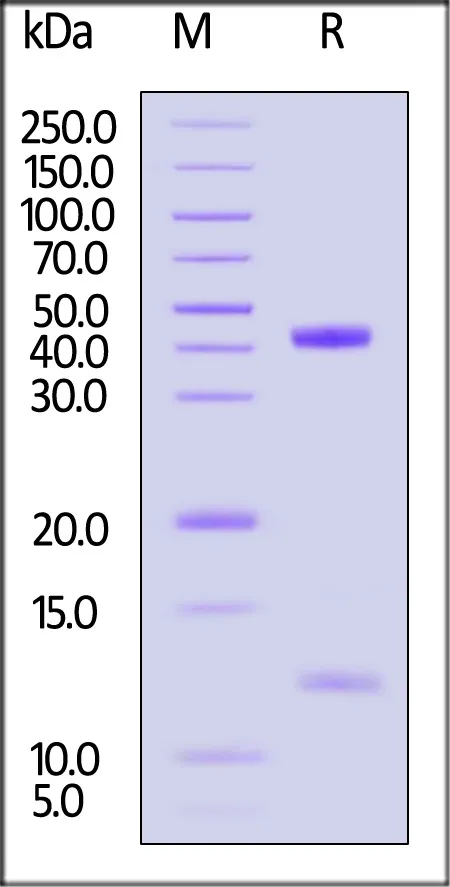 Biotinylated Human HLA-A*11:01&B2M&KRASG12V (VVGAVGVGK) Complex Protein (Monomer, MALS verified) - image 1