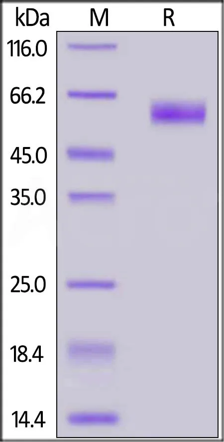 SARS-CoV-2 (COVID-19) Nucleocapsid protein, His Tag - image 1