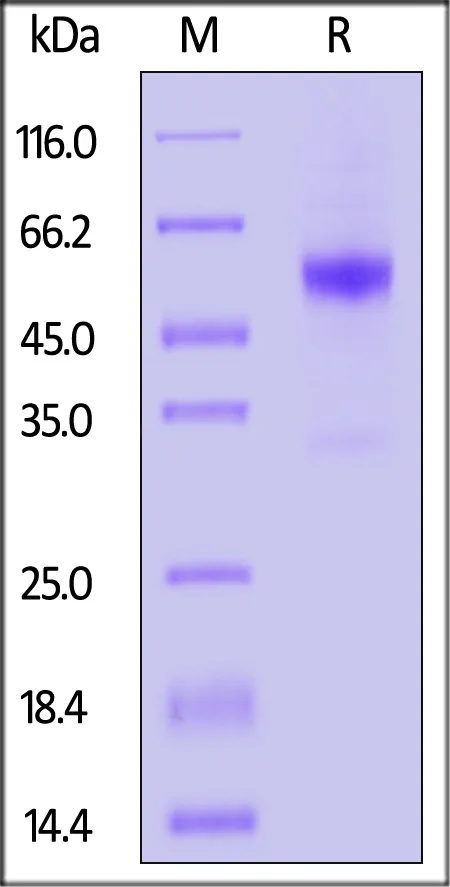 Mouse Coagulation factor VII Protein, His Tag (active enzyme, MALS verified) - image 1