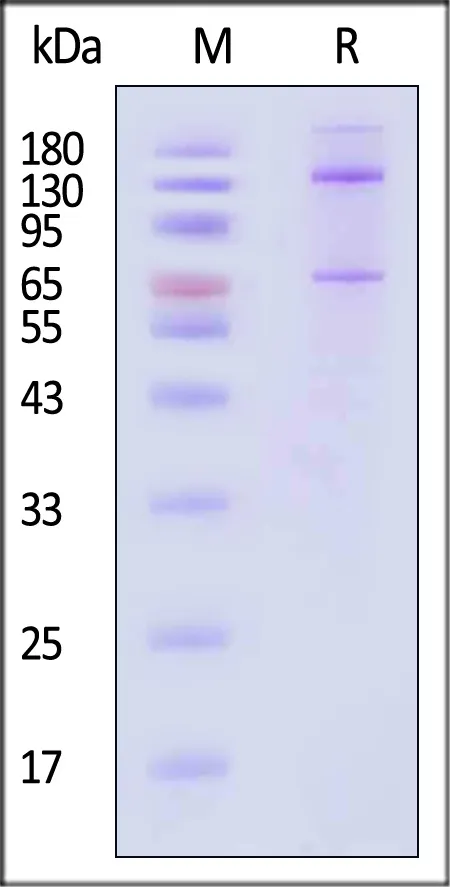 Human Complement C5 Protein, Fc Tag - image 1