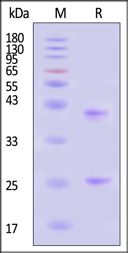 Biotinylated Human CD20 / MS4A1 Full Length Protein, His,Avitag™ (Nanodisc) - image 1