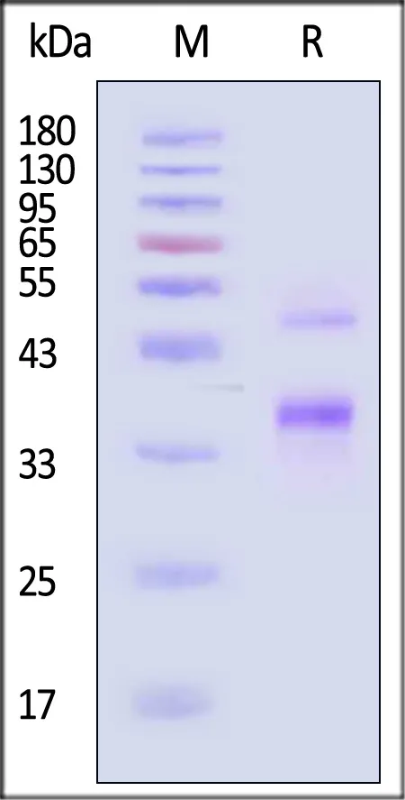 Human Coagulation factor XI / FXI Protein, His Tag (active enzyme) - image 1