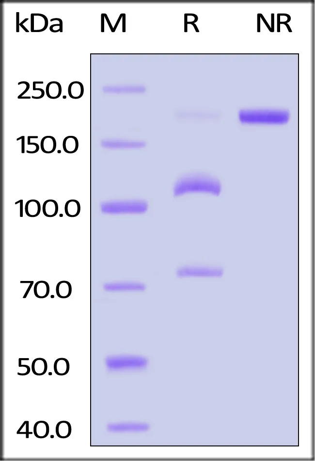 Biotinylated Human Complement C5 Protein, His,Avitag™ - image 1