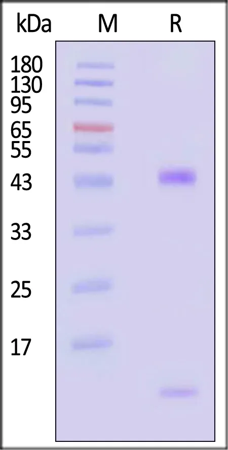 Biotinylated Human HLA-A*02:01&B2M&NY-ESO-1 (SLLMWITQV) Complex Protein (Monomer, MALS verified) - image 1
