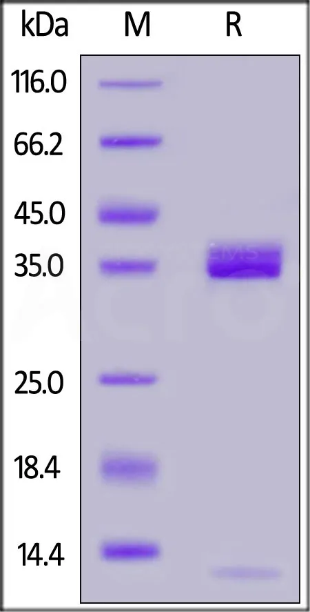 Human Apolipoprotein E / APOE3 Protein, His Tag - image 1