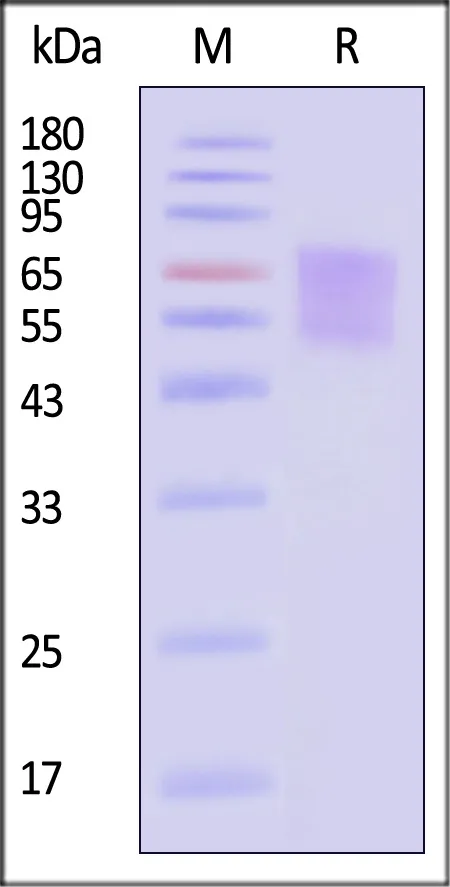 Human CD30 / TNFRSF8 Protein, His Tag - image 1