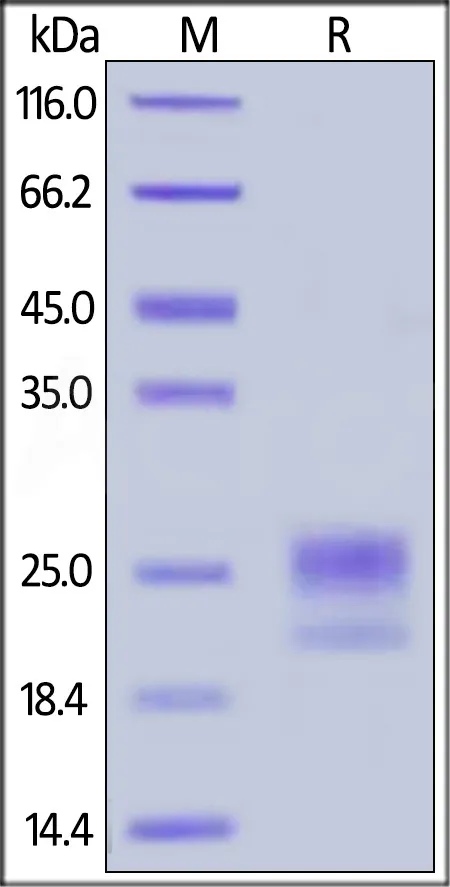 Human Niemann-Pick Type C2 / NPC2 Protein, His Tag - image 1