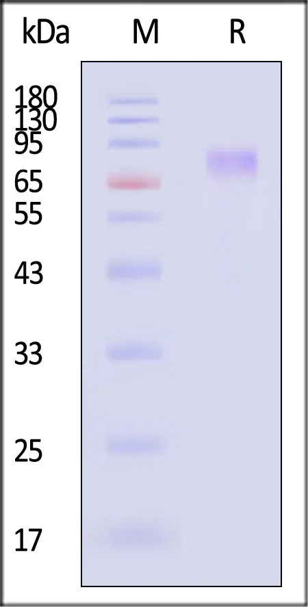 Mouse GUCY2C / Guanylyl cyclase C Protein, His Tag (MALS verified) - image 1
