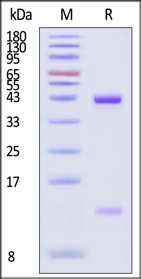 Biotinylated Human HLA-A*02:01&B2M&NY-ESO-1 (SLLMWITQC) Complex Protein (Monomer, MALS verified) - image 1