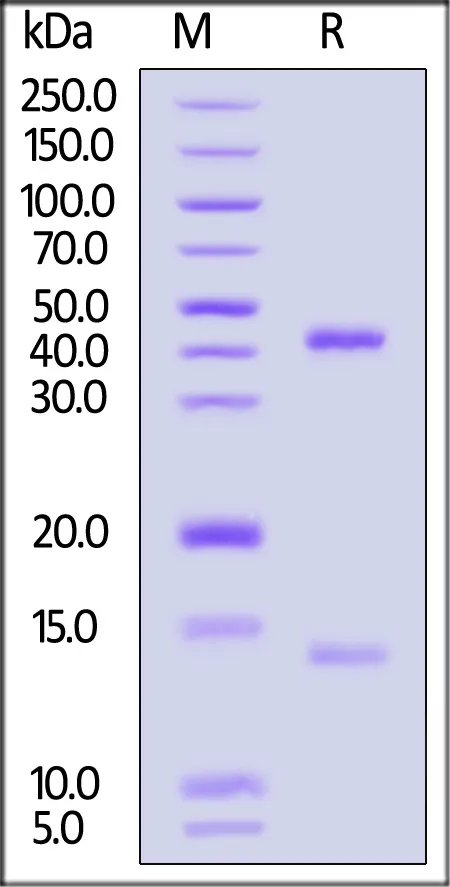 Biotinylated Human HLA-A*02:01&B2M&WT-1 (RMFPNAPYL) Complex Protein (Monomer, MALS verified) - image 1