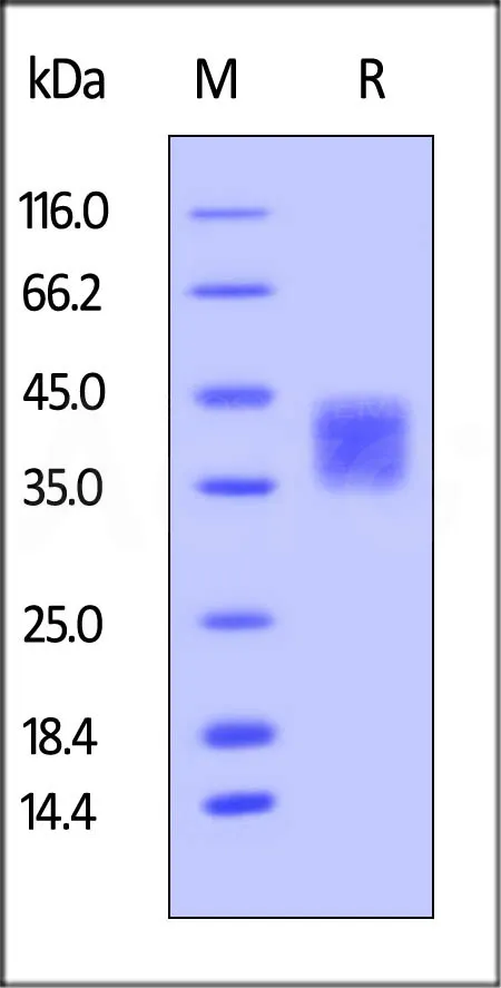 Human CD47 Protein, His Tag, low endotoxin - image 1