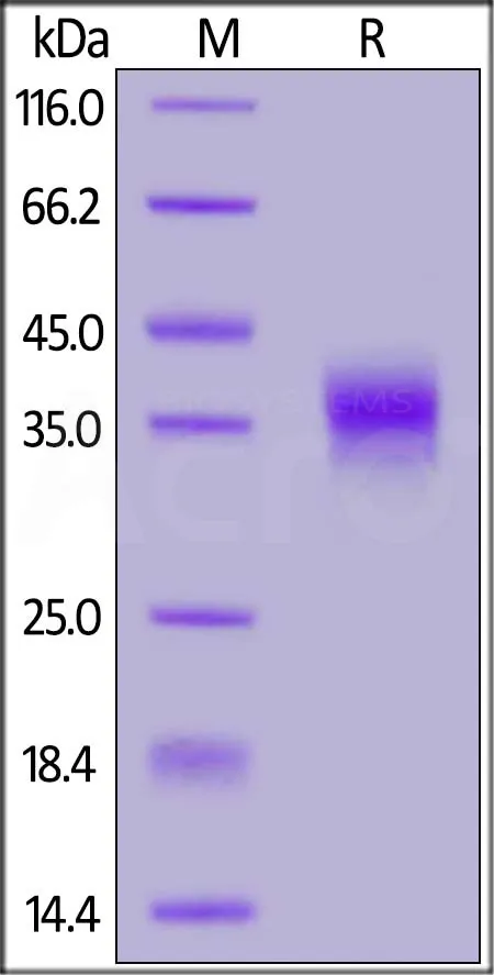 Cynomolgus / Rhesus macaque FOLR1 Protein, His tag (MALS verified) - image 1