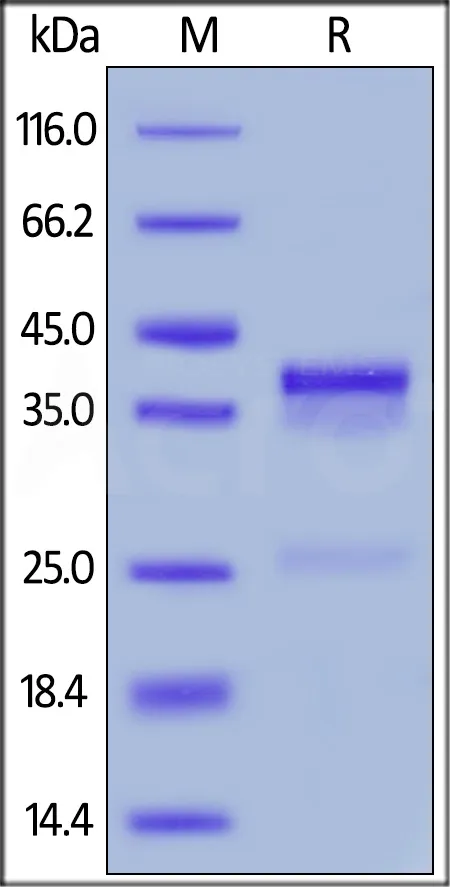 Mouse CTGF / CCN2 Protein, His Tag - image 1