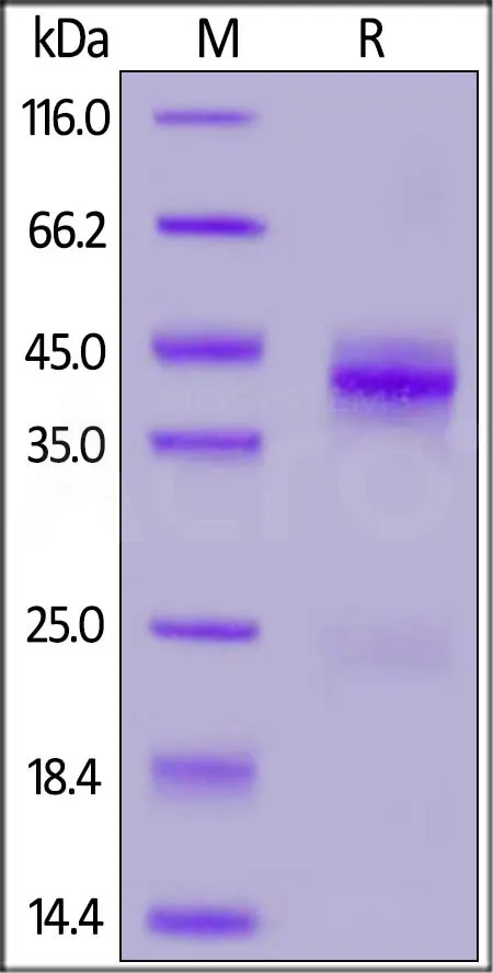 Rhesus macaque CTGF / CCN2 Protein, His Tag - image 1