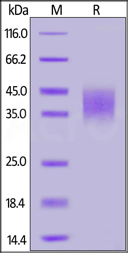 Human IFN-gamma R1 / IFNGR1 Protein, His Tag - image 1