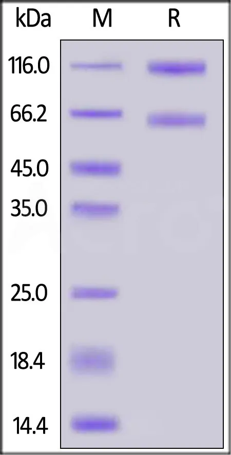 Human IL-2 R beta&IL-2 R alpha&IL-2 R gamma Protein, Fc Tag&Fc Tag (MALS verified) - image 1