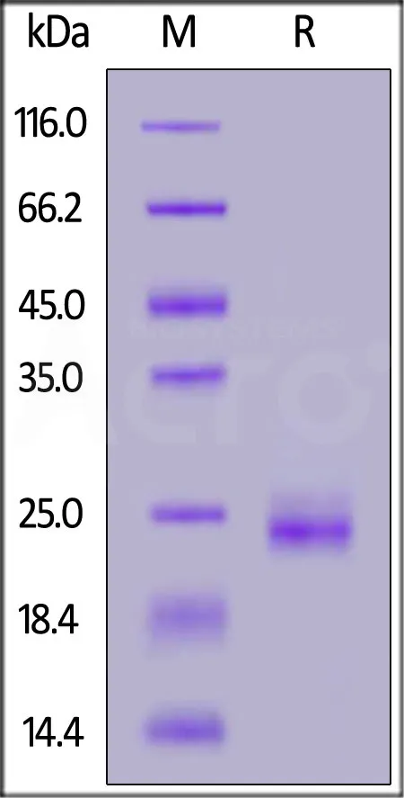 Human KRAS Protein, His Tag - image 1