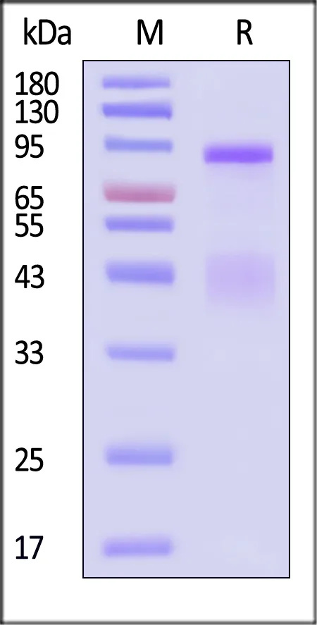 Human HGF R / c-MET Protein, His Tag (MALS verified) - image 1