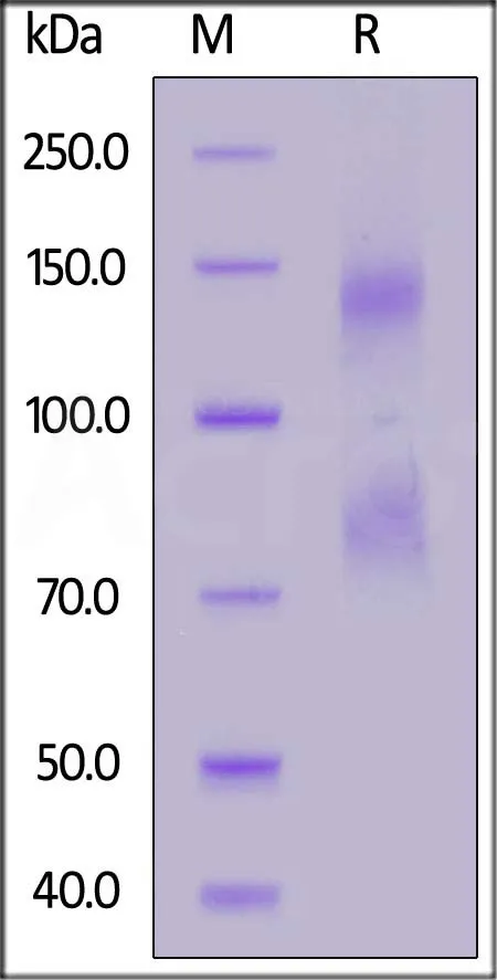 Mouse IL-2 R beta&IL-2 R alpha&IL-2 R gamma Protein, Fc Tag&Fc Tag - image 1