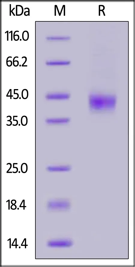Human MASP3 (450-721) Protein, His Tag (active enzyme) - image 1
