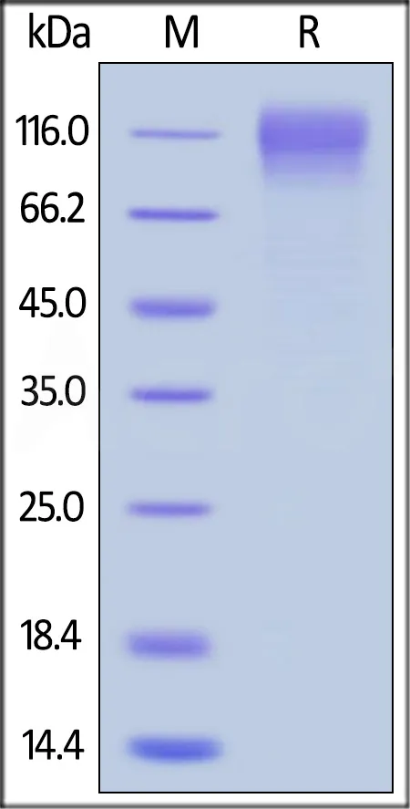 HIV-1 [HIV-1/Clade C (16055)] GP120 Protein, His Tag - image 1
