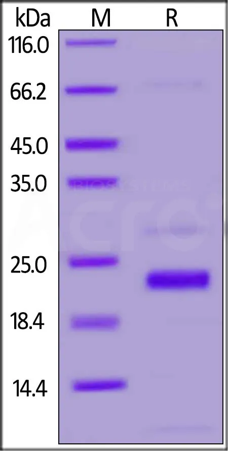 SARS-CoV-2 (COVID-19) NSP1 Protein, His Tag - image 1