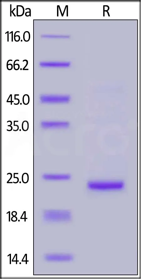 SARS-CoV-2 (COVID-19) NSP8 Protein, His Tag - image 1