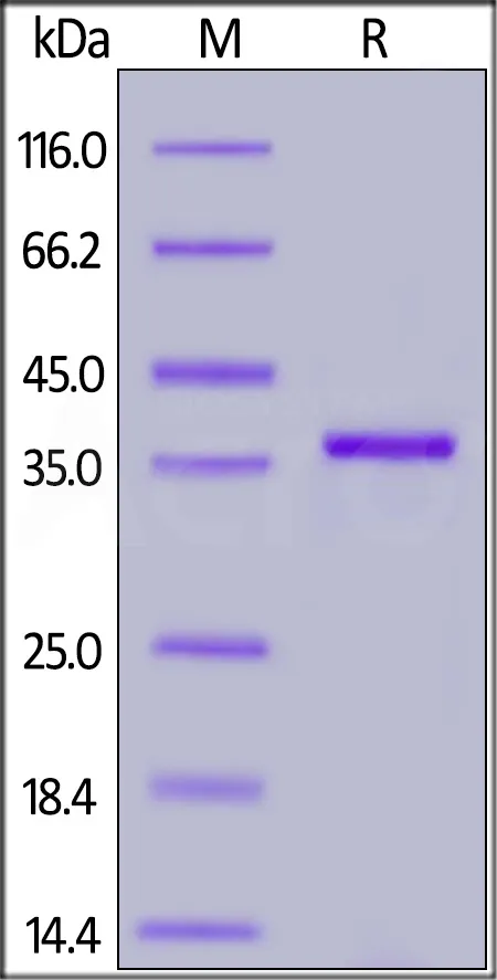 SARS-CoV-2 (COVID-19) Papain-like Protease Protein, His Tag (active enzyme) - image 1