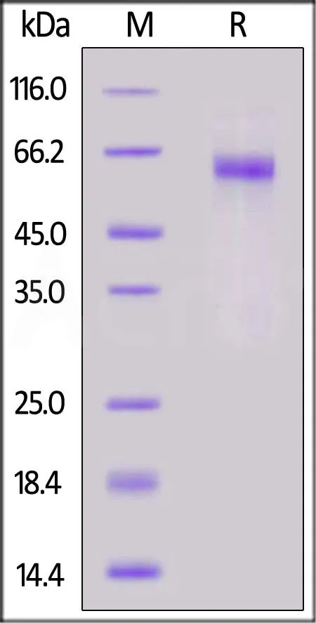 SARS-CoV-2 Nucleocapsid protein (D63G, R203M, G215C, D377Y), His Tag - image 1