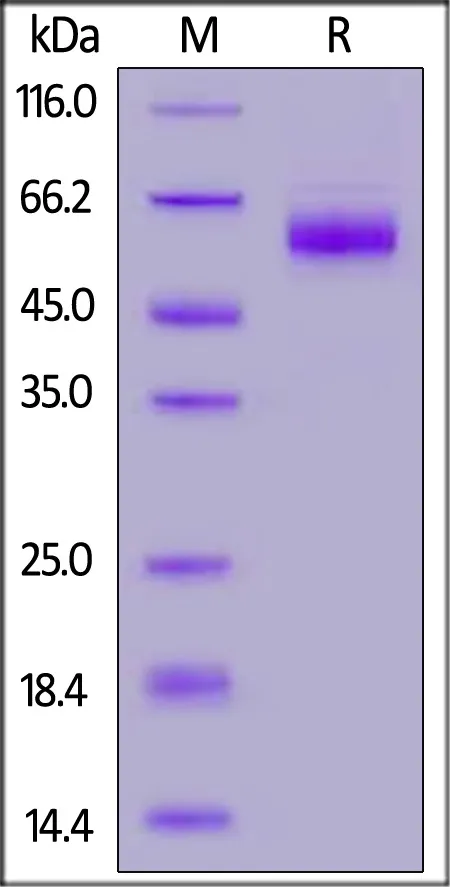 SARS-CoV-2 Nucleocapsid protein, His Tag (B.1.1.529/Omicron) - image 1