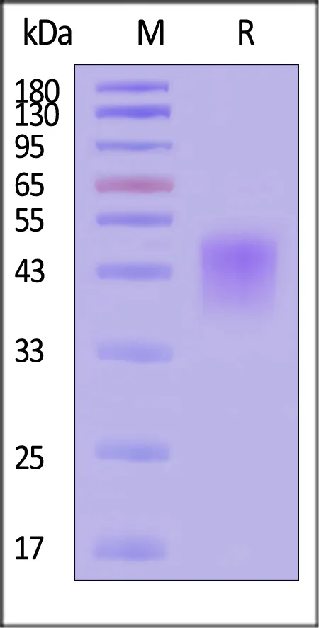 Human Fc gamma RIIIA / CD16a (F176) Protein, His Tag (MALS & SPR verified) - image 1