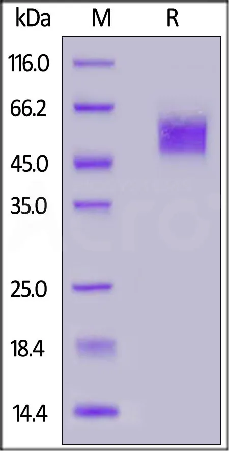 Human Fc gamma RIIIA / CD16a (V176) Protein, SUMO,His Tag (MALS & BLI verified) - image 1