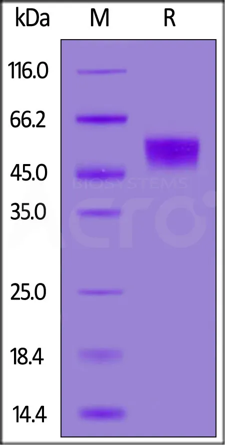 Human Fc gamma RIIIB / CD16b (NA1) Protein, SUMO,His Tag (MALS & BLI-verified) - image 1