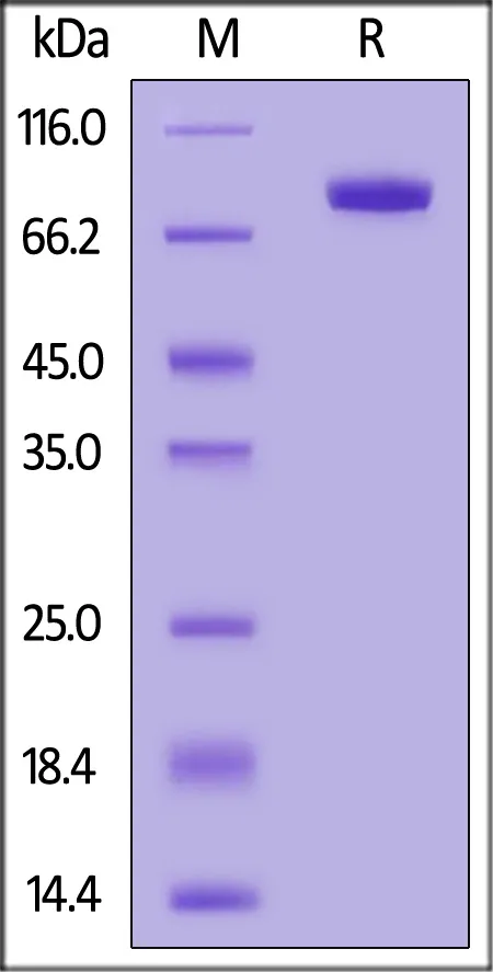 Human DDR1 Protein, Fc Tag - image 1
