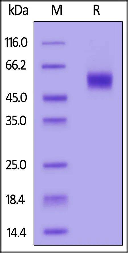 Cynomolgus IL-1 RAcP / IL-1 R3 Protein, His Tag - image 1