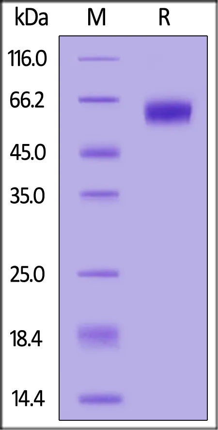 Biotinylated Human DDR1 Protein, His,Avitag™ (MALS verified) - image 1