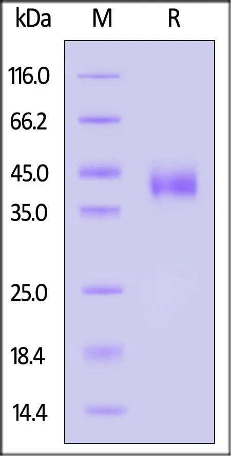 Human IL-28 R alpha / IFN-lambda R1 Protein, His Tag - image 1